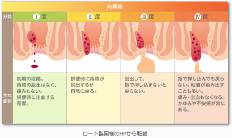 進行度